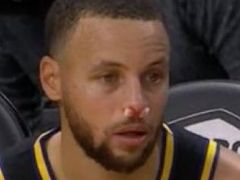 没哨子！库里被打出鼻血后遭到裁判无视