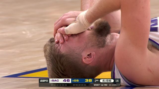 【2023年04月29日 国王vs勇士集锦】卢尼跳球下落肘击小萨面部 小萨痛苦倒地紧急处理伤势